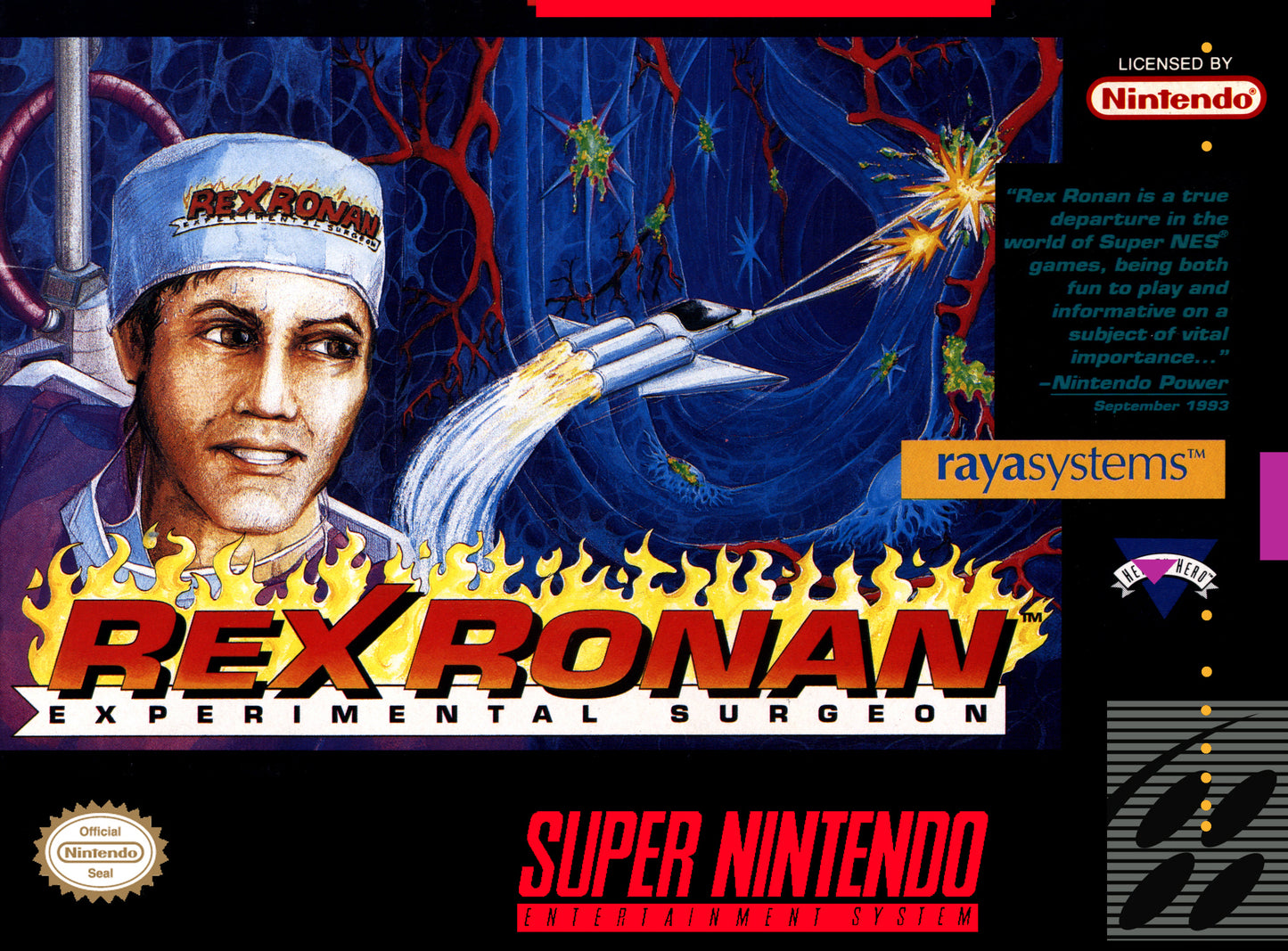 REX RONAN: EXPERIMENTAL SURGEON - SNES (W/BOX)