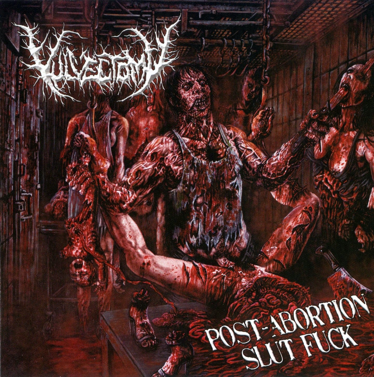 VULVECTOMY - POST-ABORTION SLUT FUCK