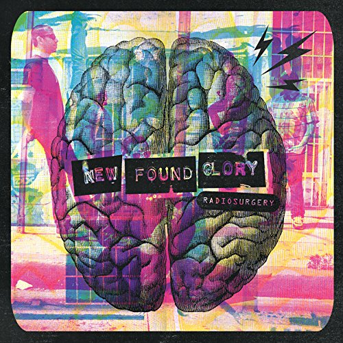 NEW FOUND GLORY - RADIOSURGERY (DLX ED)