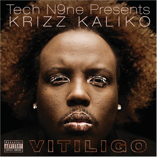 KALIKO, KRIZZ - VITILIGO